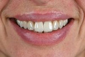 All On 4 - 17895 предложения