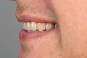 All On 4 - 97949 отстъпки