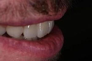 дентална клиника софия - 53219 клиенти