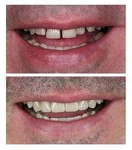 дентална клиника софия - 84518 вида