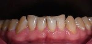 скърцане със зъби - 94731 награди