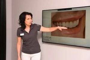 зъбни фасети - 33799 комбинации