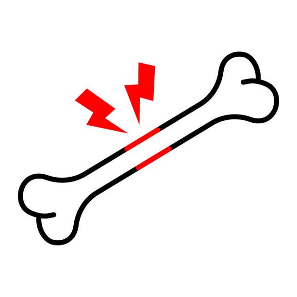 костна плътност - 52815 комбинации